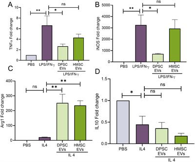 Immunomodulatory properties of naïve and inflammation-informed dental pulp stem cell derived extracellular vesicles